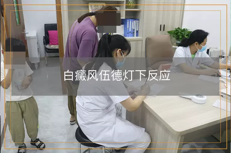 白癜风伍德灯下反应