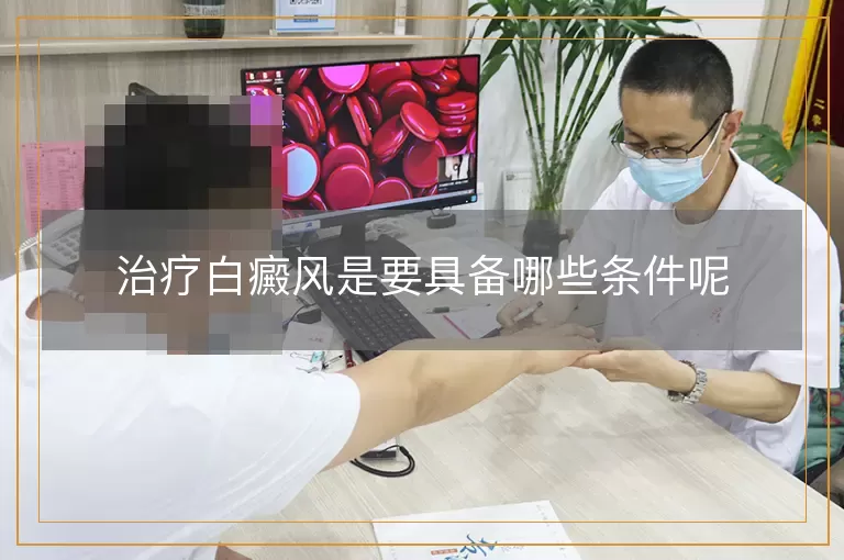 治疗白癜风是要具备哪些条件呢