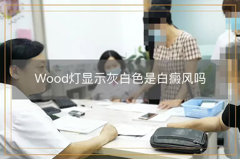 Wood灯显示灰白色是白癜风吗