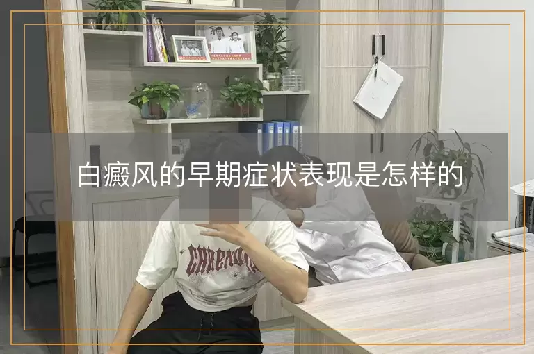 白癜风的早期症状表现是怎样的