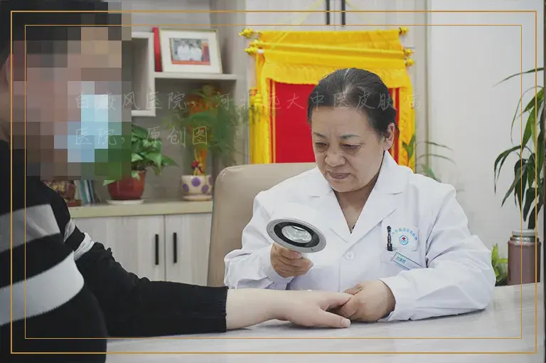 uvb照白癜风后发红了怎么回事