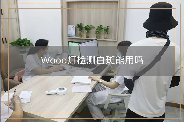 Wood灯检测白斑能用吗