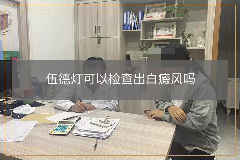 伍德灯可以检查出白癜风吗