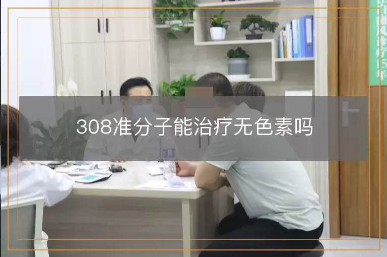 308准分子能治疗无色素吗