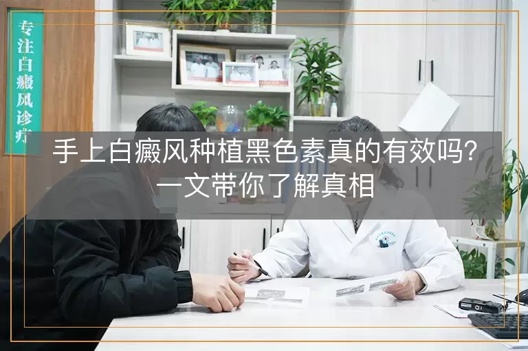 手上白癜风种植黑色素真的有效吗？一文带你了解真相