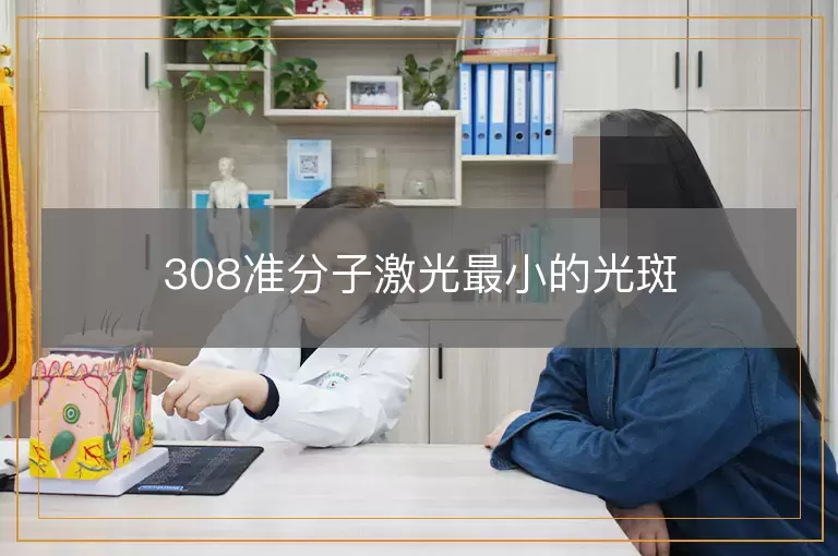 308准分子激光最小的光斑