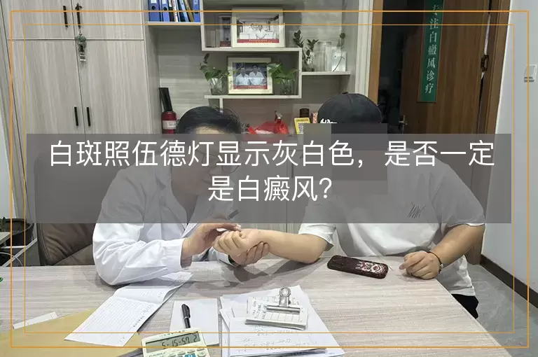 白斑照伍德灯显示灰白色，是否一定是白癜风？