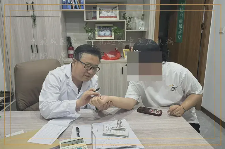 嘴唇下长白癜风怎么知道病因