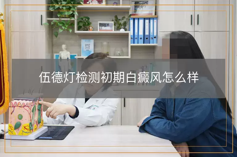 伍德灯检测初期白癜风怎么样