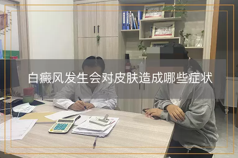 白癜风发生会对皮肤造成哪些症状