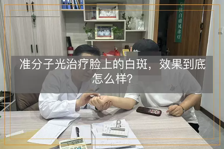 准分子光治疗脸上的白斑，效果到底怎么样？