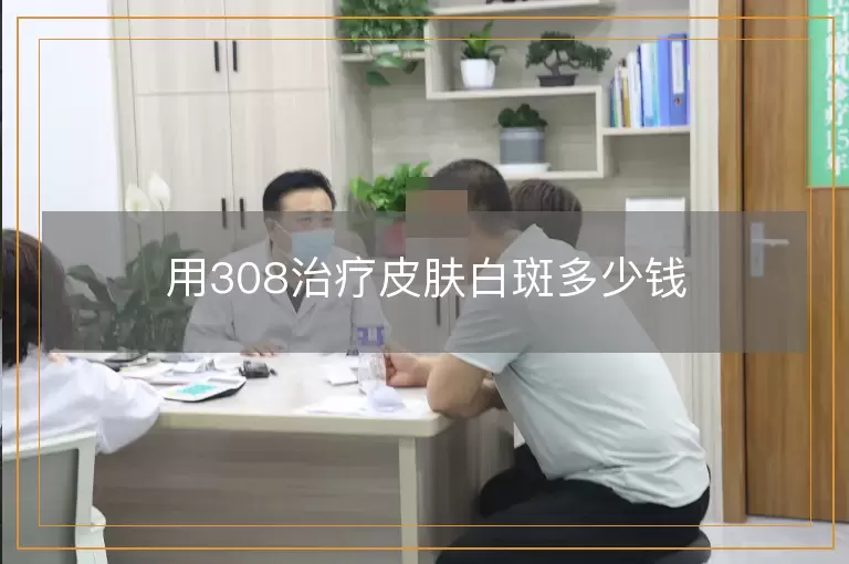 用308治疗皮肤白斑多少钱