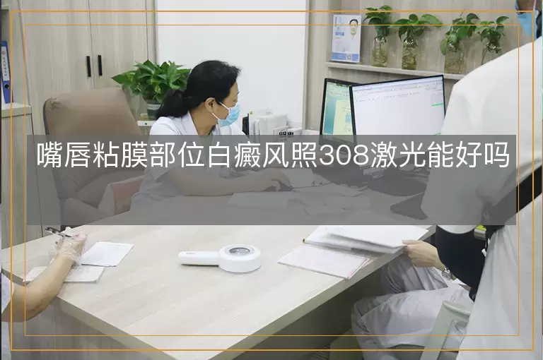 嘴唇粘膜部位白癜风照308激光能好吗