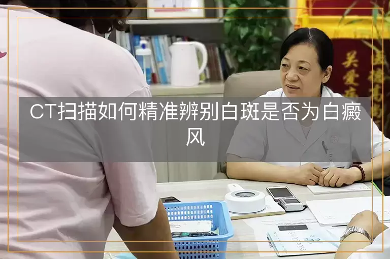 CT扫描如何精准辨别白斑是否为白癜风