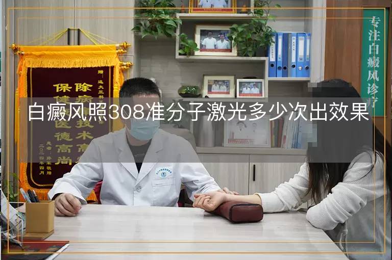 白癜风照308准分子激光多少次出效果