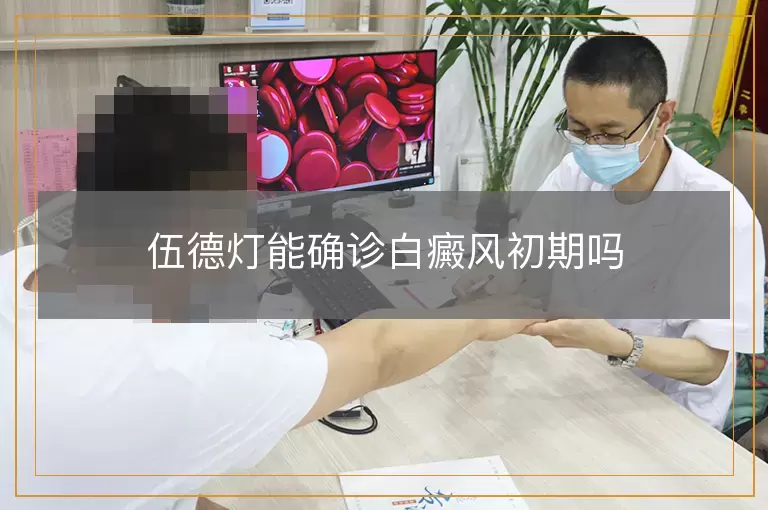 伍德灯能确诊白癜风初期吗