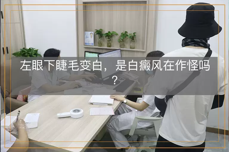 左眼下睫毛变白，是白癜风在作怪吗？