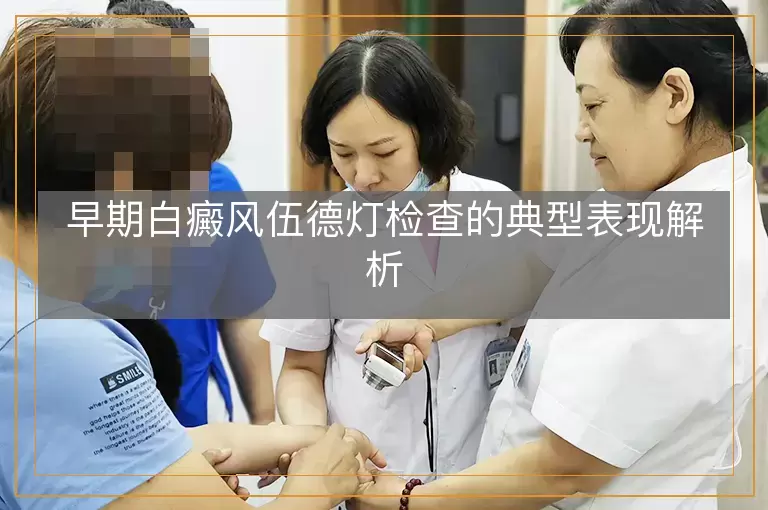 早期白癜风伍德灯检查的典型表现解析