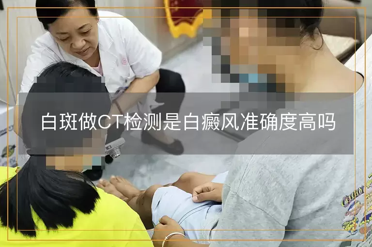 白斑做CT检测是白癜风准确度高吗