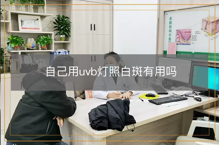 自己用uvb灯照白斑有用吗