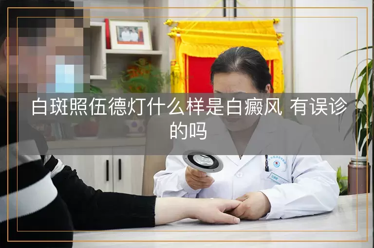 白斑照伍德灯什么样是白癜风 有误诊的吗