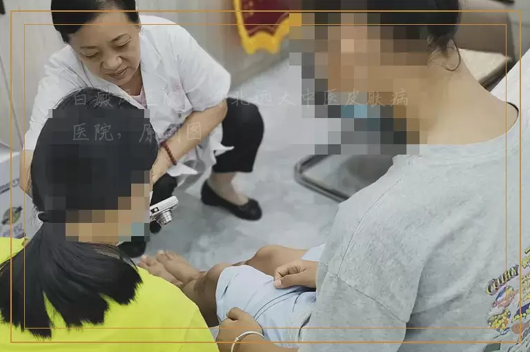 背上出现白斑2个月了是白癜风吗