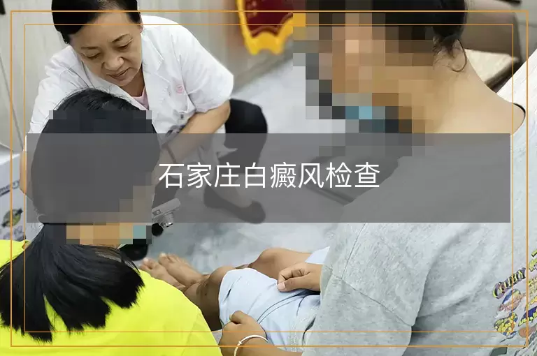 石家庄白癜风检查
