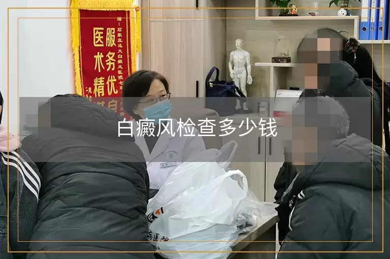 白癜风检查多少钱