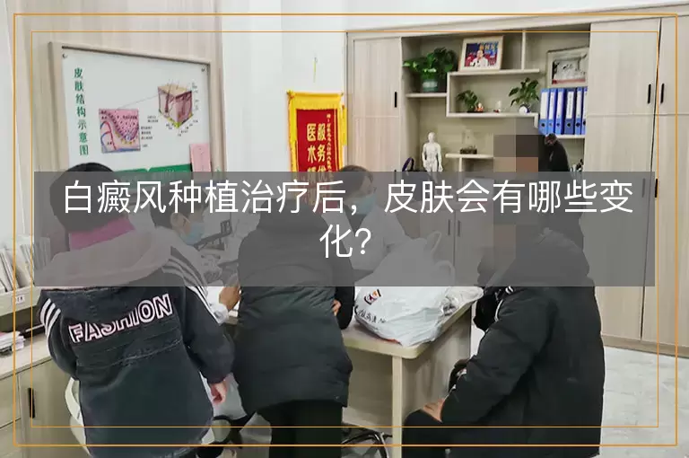 白癜风种植治疗后，皮肤会有哪些变化？