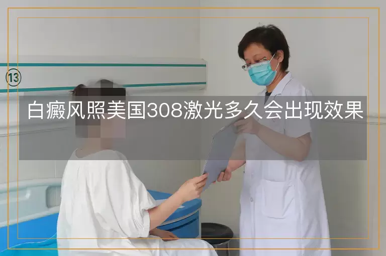 白癜风照美国308激光多久会出现效果