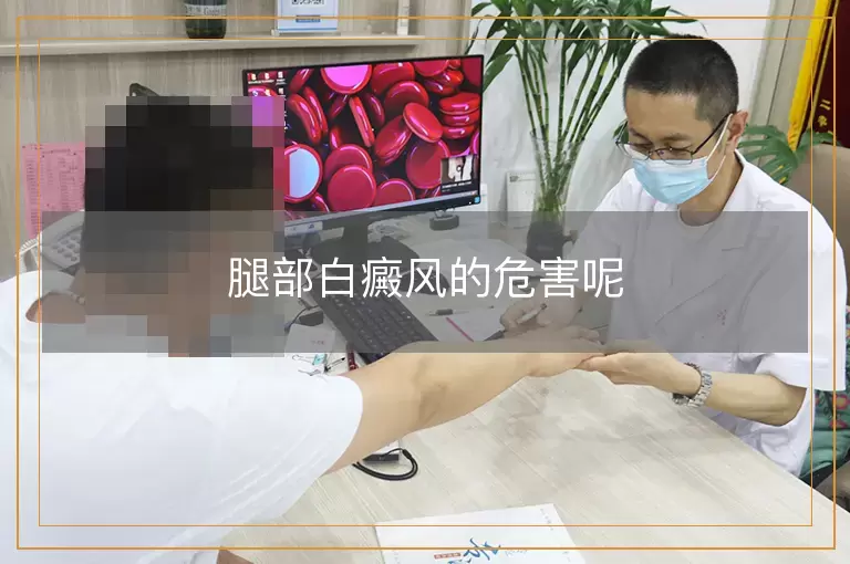 腿部白癜风的危害呢