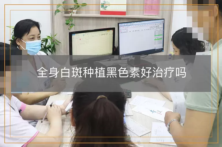 全身白斑种植黑色素好治疗吗
