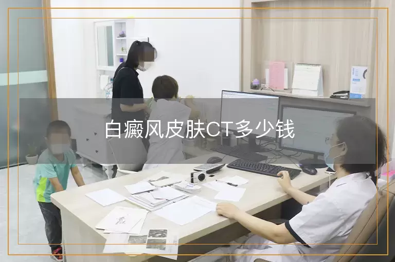 白癜风皮肤CT多少钱