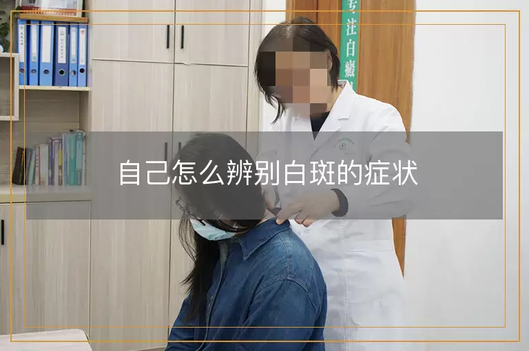 自己怎么辨别白斑的症状