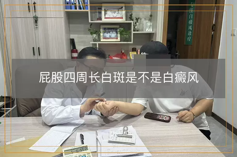 屁股四周长白斑是不是白癜风