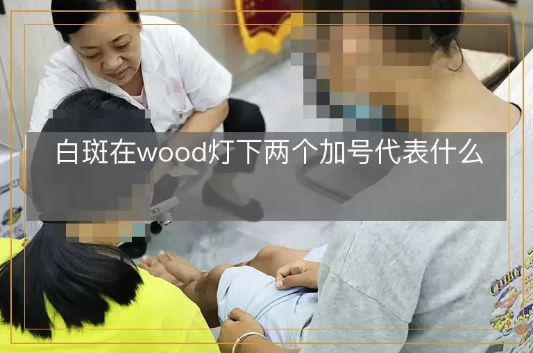 白斑在wood灯下两个加号代表什么