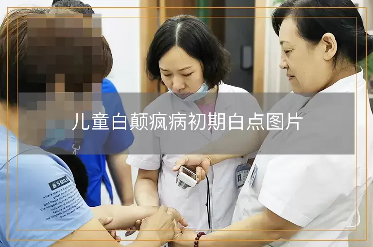 儿童白颠疯病初期白点图片
