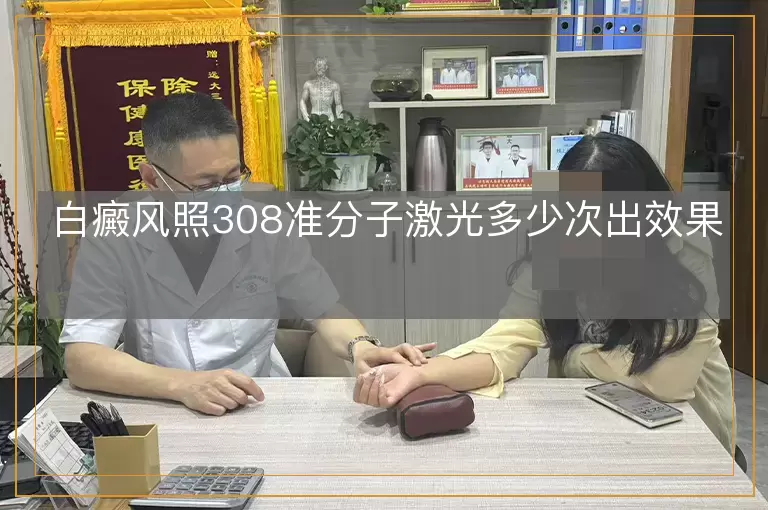 白癜风照308准分子激光多少次出效果
