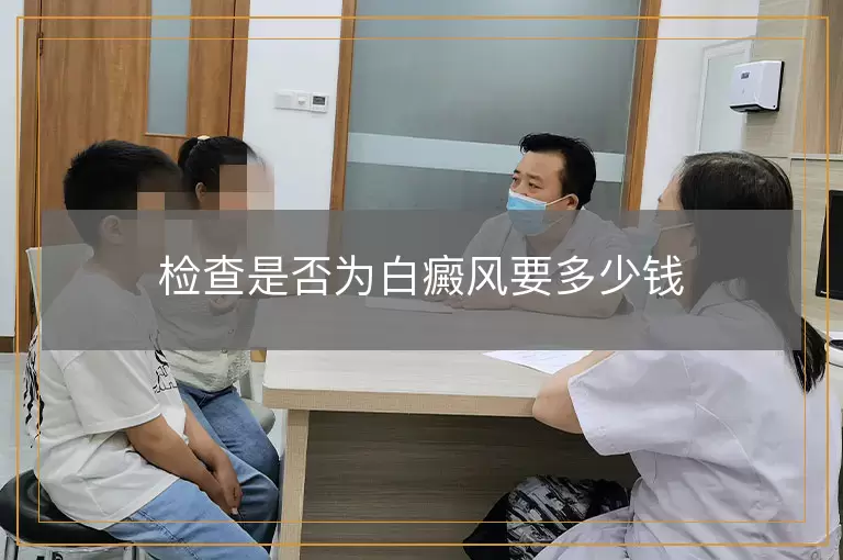 检查是否为白癜风要多少钱