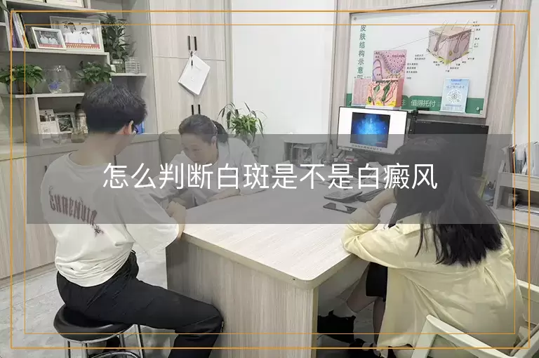 怎么判断白斑是不是白癜风