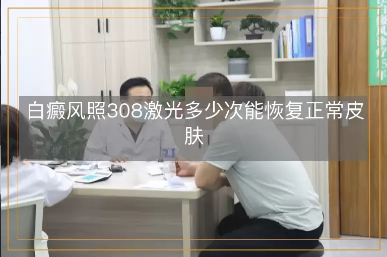 白癜风照308激光多少次能恢复正常皮肤