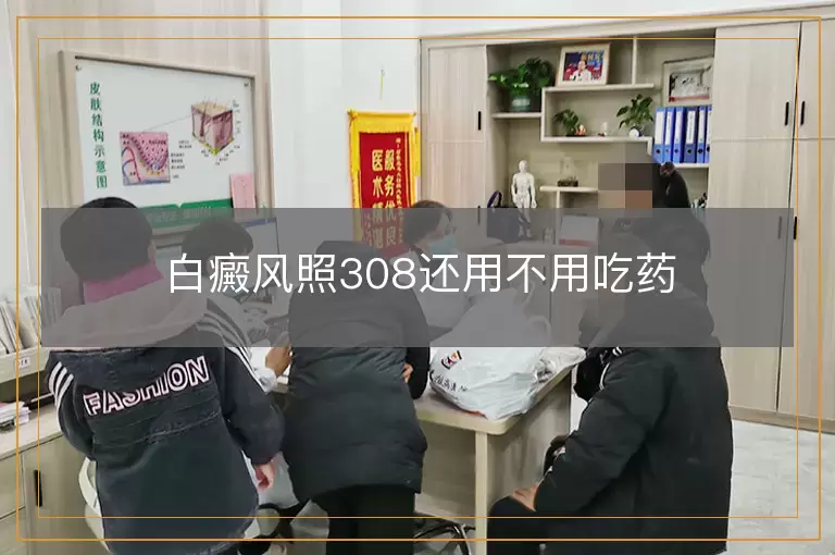 白癜风照308还用不用吃药