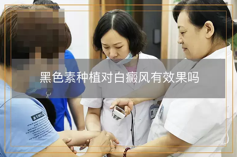 黑色素种植对白癜风有效果吗