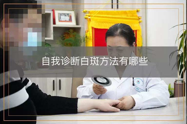 自我诊断白斑方法有哪些