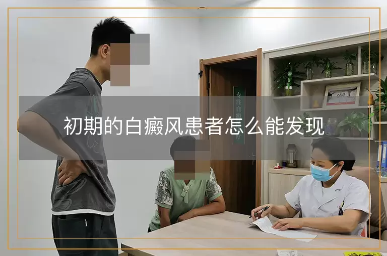 初期的白癜风患者怎么能发现
