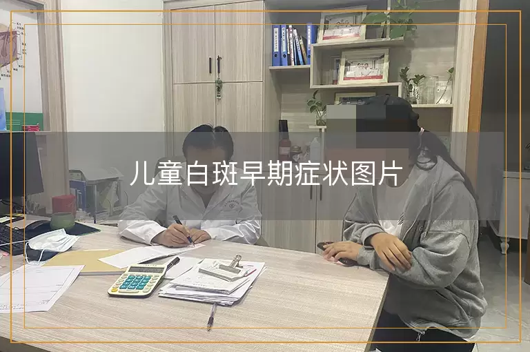 儿童白斑早期症状图片