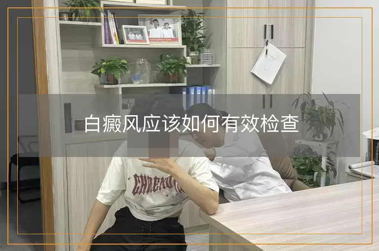 白癜风应该如何有效检查