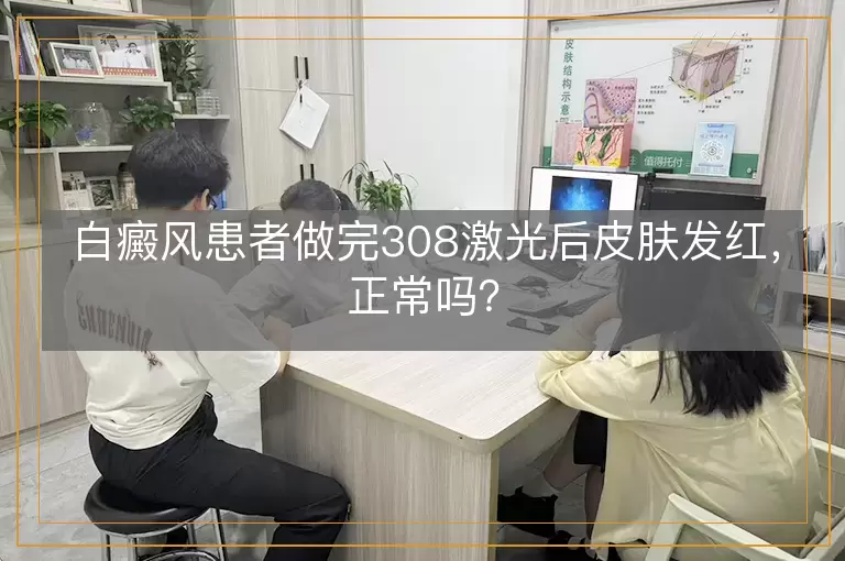 白癜风患者做完308激光后皮肤发红，正常吗？