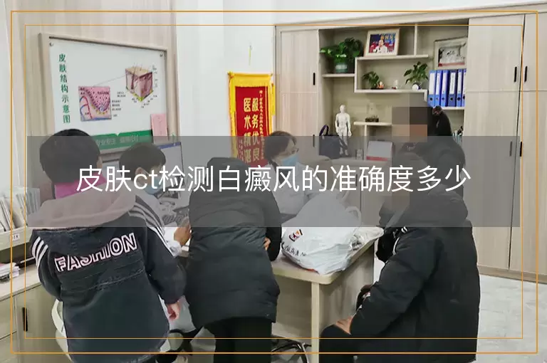 皮肤ct检测白癜风的准确度多少