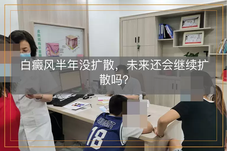 白癜风半年没扩散，未来还会继续扩散吗？